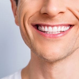 Invisalign Invisalign